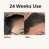 4 in 1 Hair Oil
